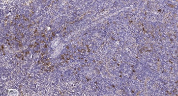 PDGFR-α (phospho Tyr762) rabbit pAb Antibody