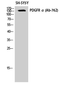 PDGFR-α rabbit pAb Antibody