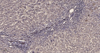 PDGFR-β (phospho Tyr771) rabbit pAb Antibody