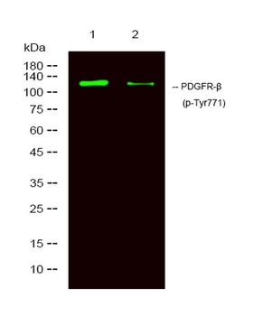 PDGFR-β (phospho Tyr771) rabbit pAb Antibody
