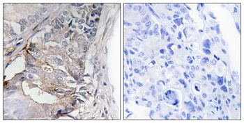 PDGFR-β (phospho Tyr740) rabbit pAb