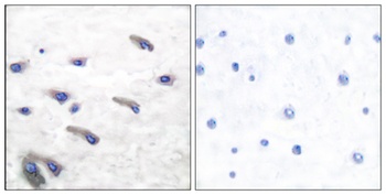PDGFR-β (phospho Tyr751) rabbit pAb