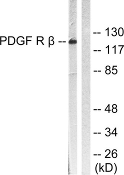 PDGFR-β rabbit pAb Antibody