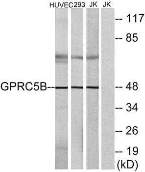 GPRC5B rabbit pAb Antibody
