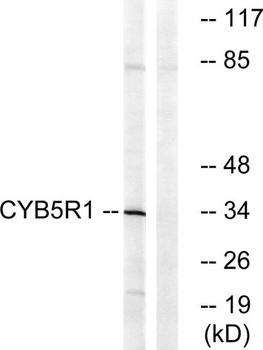 CYB5R1 rabbit pAb Antibody