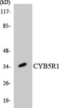 CYB5R1 rabbit pAb Antibody