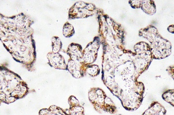 PEDF rabbit pAb Antibody