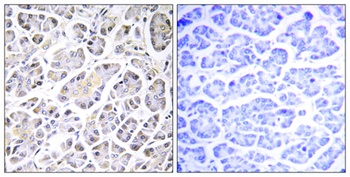 ATP5G3 rabbit pAb Antibody
