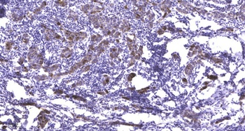 PHAX rabbit pAb Antibody