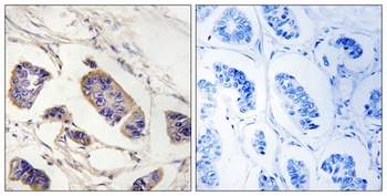 Peroxin 7 rabbit pAb Antibody