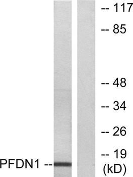 Prefoldin 1 rabbit pAb Antibody