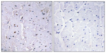 Pin1 (phospho Ser16) rabbit pAb