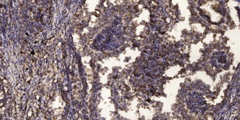 PLC β2 rabbit pAb Antibody