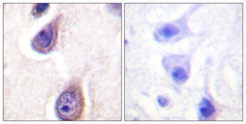 PC-PLD1 (phospho Ser561) rabbit pAb