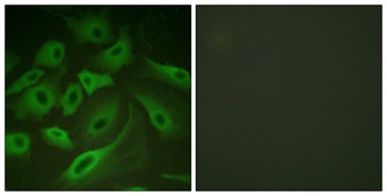 PLB rabbit pAb Antibody