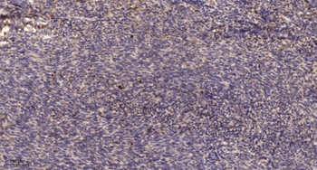 PLB rabbit pAb Antibody