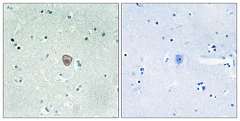 EDG-8 rabbit pAb Antibody