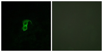 GPR87 rabbit pAb Antibody