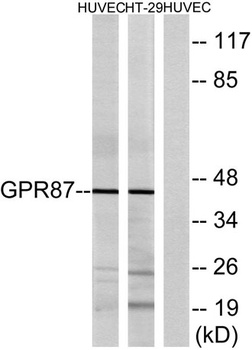 GPR87 rabbit pAb Antibody