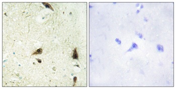 CHRAC15 rabbit pAb Antibody