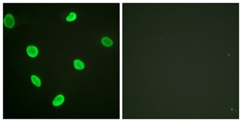 Acetyl Histone H2B (K12) rabbit pAb Antibody