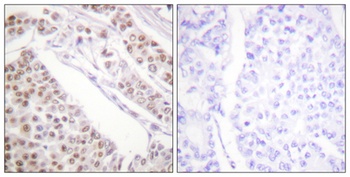 Acetyl Histone H2B (K12) rabbit pAb Antibody