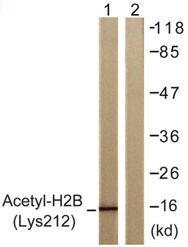 Acetyl Histone H2B (K12) rabbit pAb Antibody