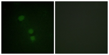 Histone H2B (Acetyl Lys15) rabbit pAb Antibody