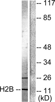 Histone H2B (Acetyl Lys15) rabbit pAb Antibody