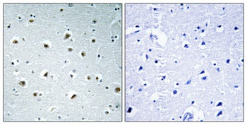 POLR2E rabbit pAb Antibody