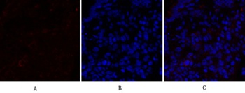 PPAR-α rabbit pAb Antibody