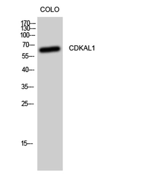 CDKAL1 rabbit pAb Antibody