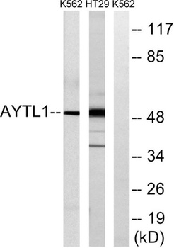 LPCAT2 rabbit pAb Antibody