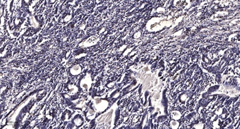 LPCAT2 rabbit pAb Antibody