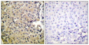 PP1α (phospho Thr320) rabbit pAb