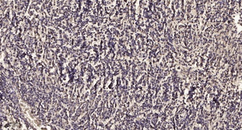 MARCH1 rabbit pAb Antibody