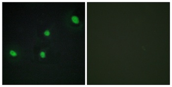 CdcA4 rabbit pAb Antibody