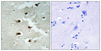 CdcA4 rabbit pAb Antibody