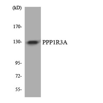 PPP1R3A rabbit pAb Antibody