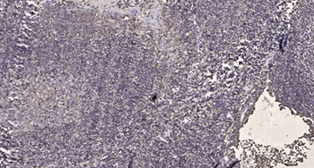 PPP1R3A rabbit pAb Antibody