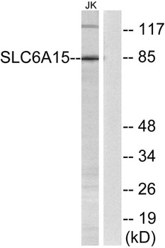 SLC6A15 rabbit pAb Antibody
