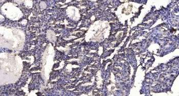 SLC6A15 rabbit pAb Antibody