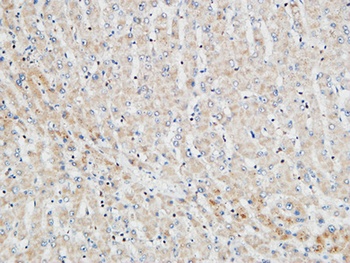 PKC α rabbit pAb Antibody