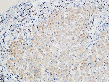 PKC α rabbit pAb Antibody