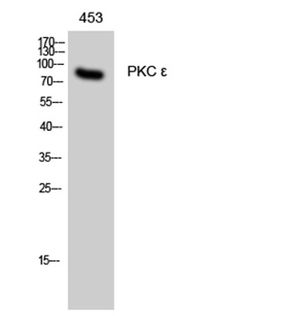 PKC ε rabbit pAb Antibody