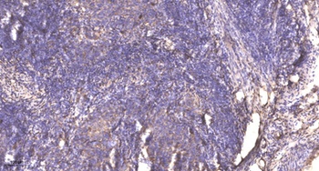 PKN rabbit pAb Antibody