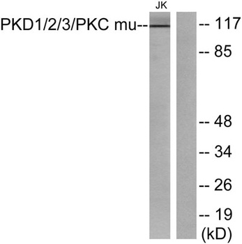 PKD1/2/3 rabbit pAb Antibody