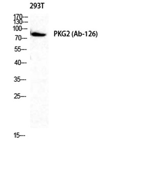cGKII rabbit pAb Antibody