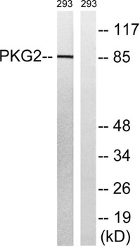 cGKII rabbit pAb Antibody