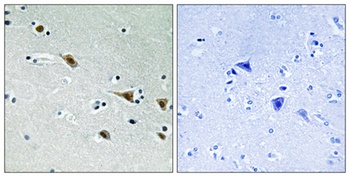 MEK-7 (phospho Ser271) rabbit pAb Antibody